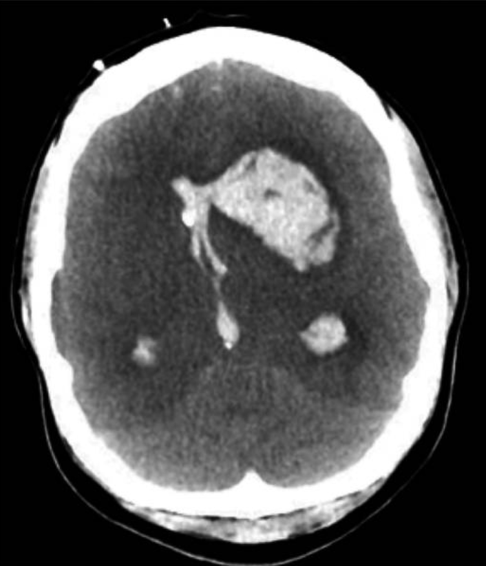 Зображення, що містить чорно-білий, пліснява

Автоматично згенерований опис