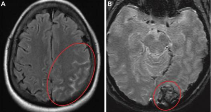 Зображення, що містить Медична візуалізація, рентгенологія, медичний, Медична радіографія

Автоматично згенерований опис