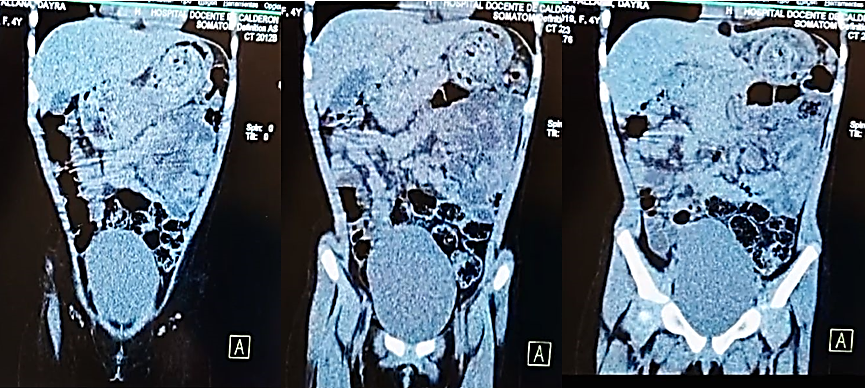 Imagen que contiene cubierto, tabla, foto, nieve

Descripción generada automáticamente